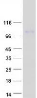 Human NCKAP5 Protein (Recombinant Myc-DDK (Flag))