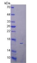 Mouse Reg3b Protein (Recombinant His, N-Terminal)