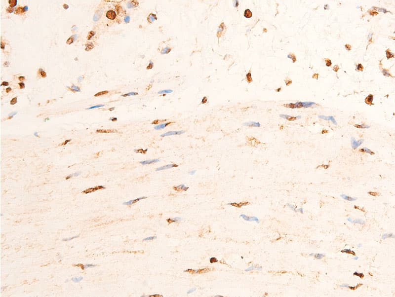 Polyclonal Rabbit anti-Human CHEK2 / CHK2 Antibody (phospho-Thr383, IHC, IF, WB)