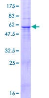 Human FBXO27 Protein (Recombinant GST)