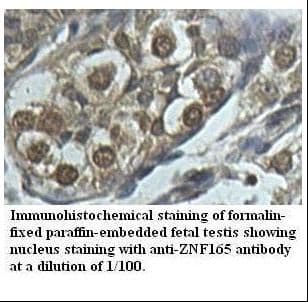 ZNF165 Antibody