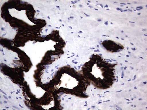 KRT19 / CK19 / Cytokeratin 19 Antibody (aa240-390, clone OTI8A1)