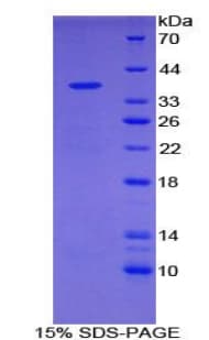 Mouse MT-ND1 Protein (Recombinant His-GST)