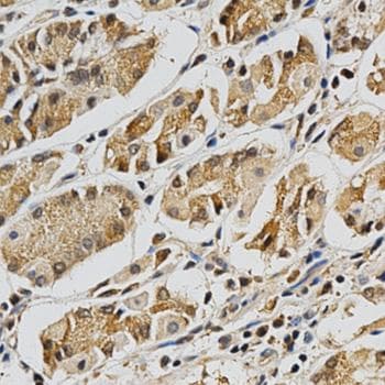 LGALS3 / Galectin 3 Antibody