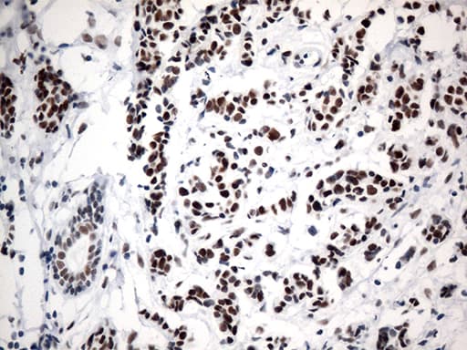 Monoclonal Mouse anti-Human GTF3C4 Antibody (clone OTI4A3, aa583-822, IHC, WB)