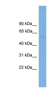 ESR2 / ER Beta Antibody (aa35-84)