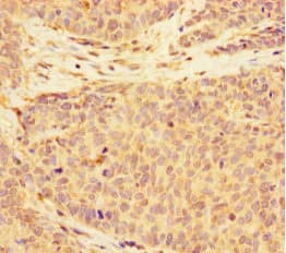 ALS2CR11 Antibody