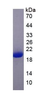 Human IFNAR1 / IFNAR Protein (Recombinant)