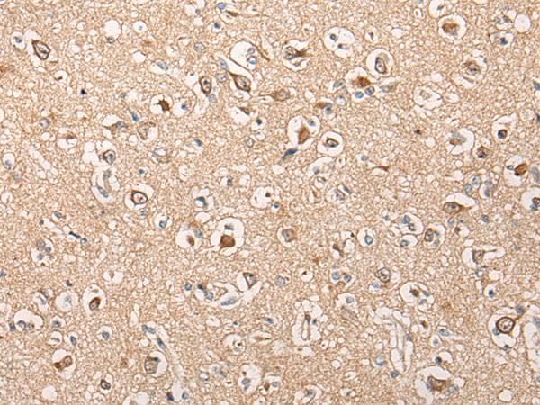 HTRA1 Antibody