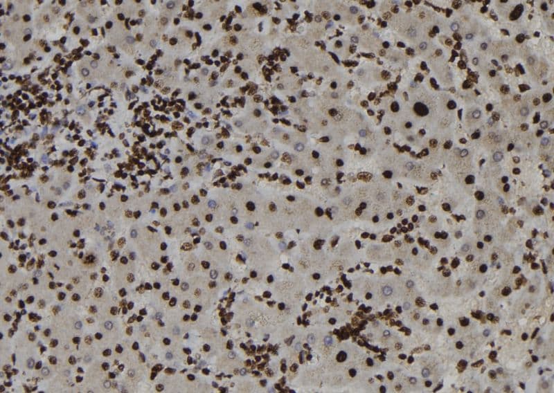 Polyclonal Rabbit anti-Human PARP13 / ZC3HAV1 Antibody (IHC, WB)