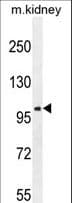 GRIA4 / GLUR4 Antibody (aa259-287)