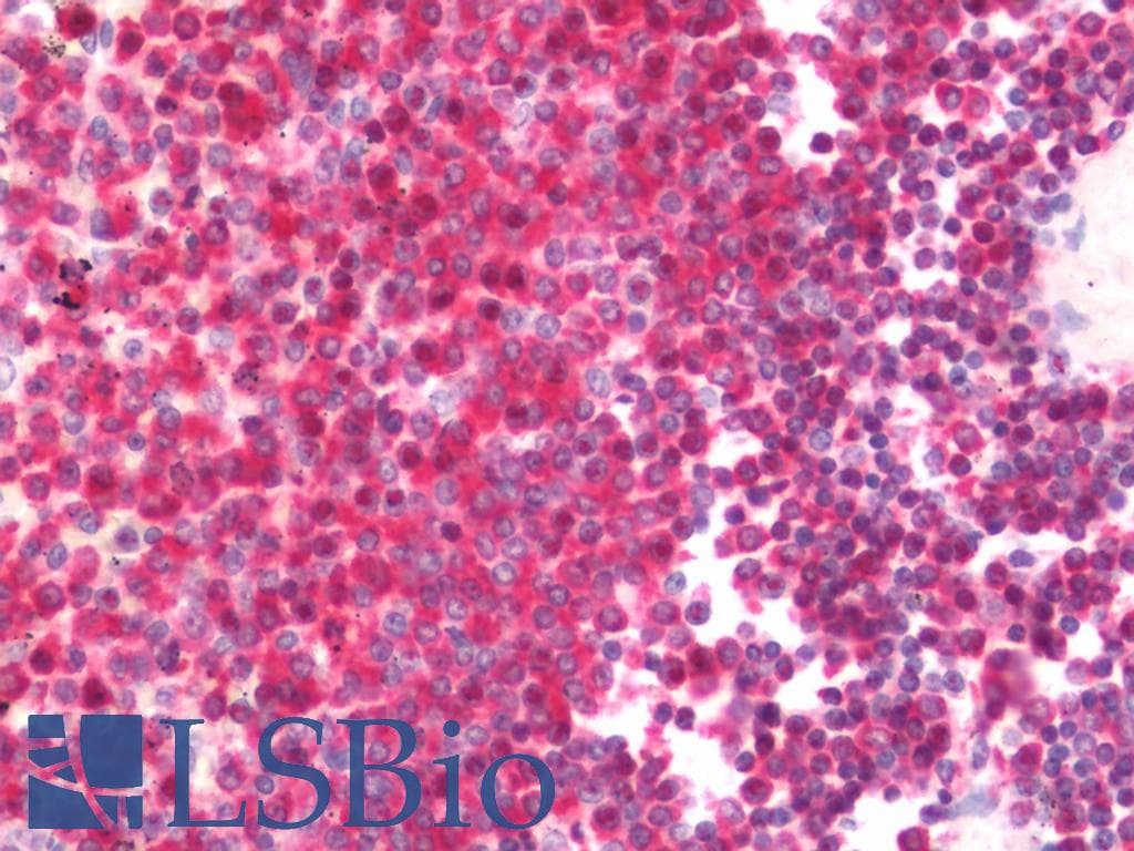 IHC-plus™ PINK1 Antibody