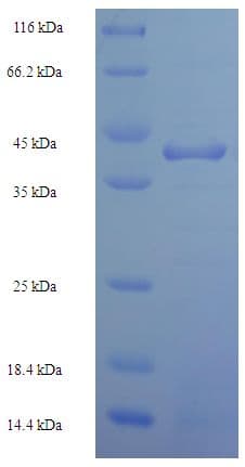 Human HNRNPL / hnRNP L Protein (Recombinant His-SUMO)