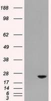 Monoclonal Mouse anti-Human AK1 / Adenylate Kinase 1 Antibody (clone OTI18C7, IF, WB)