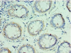 GLNRS / QARS Antibody (aa1-250)