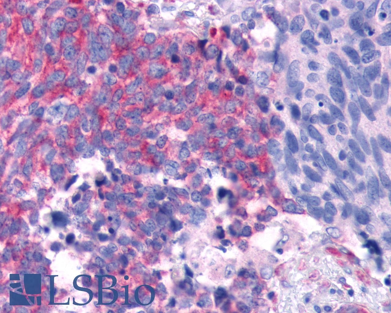 PathPlus™ TAS1R2 / T1R2 Antibody (N-Terminus)