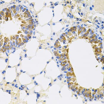 CEACAM5 / CD66e Antibody