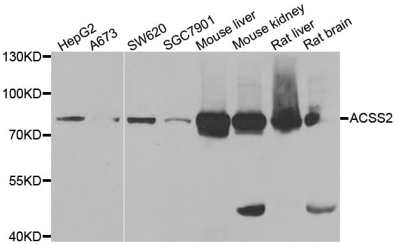 Polyclonal Rabbit anti-Human ACSS2 / ACAS2 Antibody (IHC, IF, WB)