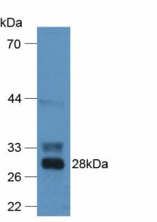 F12 / Factor XII Antibody (aa352-587)
