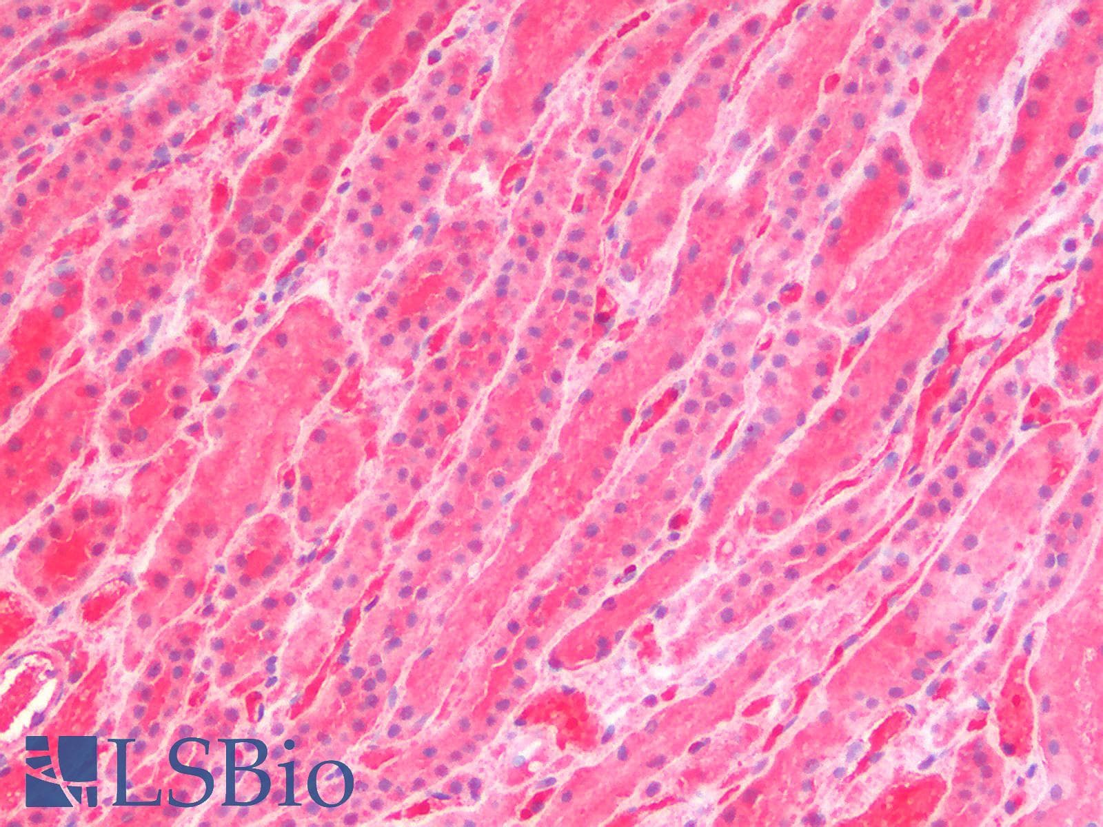 IHC-plus™ Polyclonal Goat anti-Human GSTM4-4 / GSTM4 Antibody (Internal Region, IHC, WB)