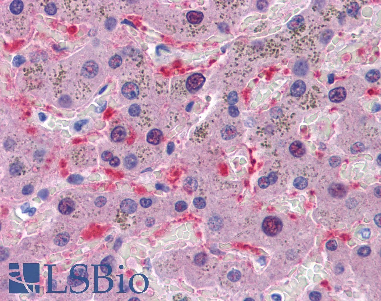 IHC-plus™ Monoclonal Mouse anti-Human AKR1B10 Antibody (clone 1A6, IHC, IF, WB)