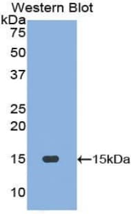 MLN / Motilin Antibody (aa25-112)