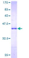 Human TXNL4A Protein (Recombinant GST)