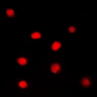 NR3C1/Glucocorticoid Receptor Antibody (Internal)