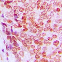 CDKN1A / WAF1 / p21 Antibody (phospho-Thr145)