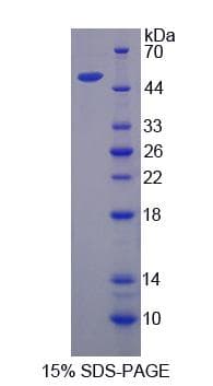 Human SEMG1 Protein (Recombinant His-S)
