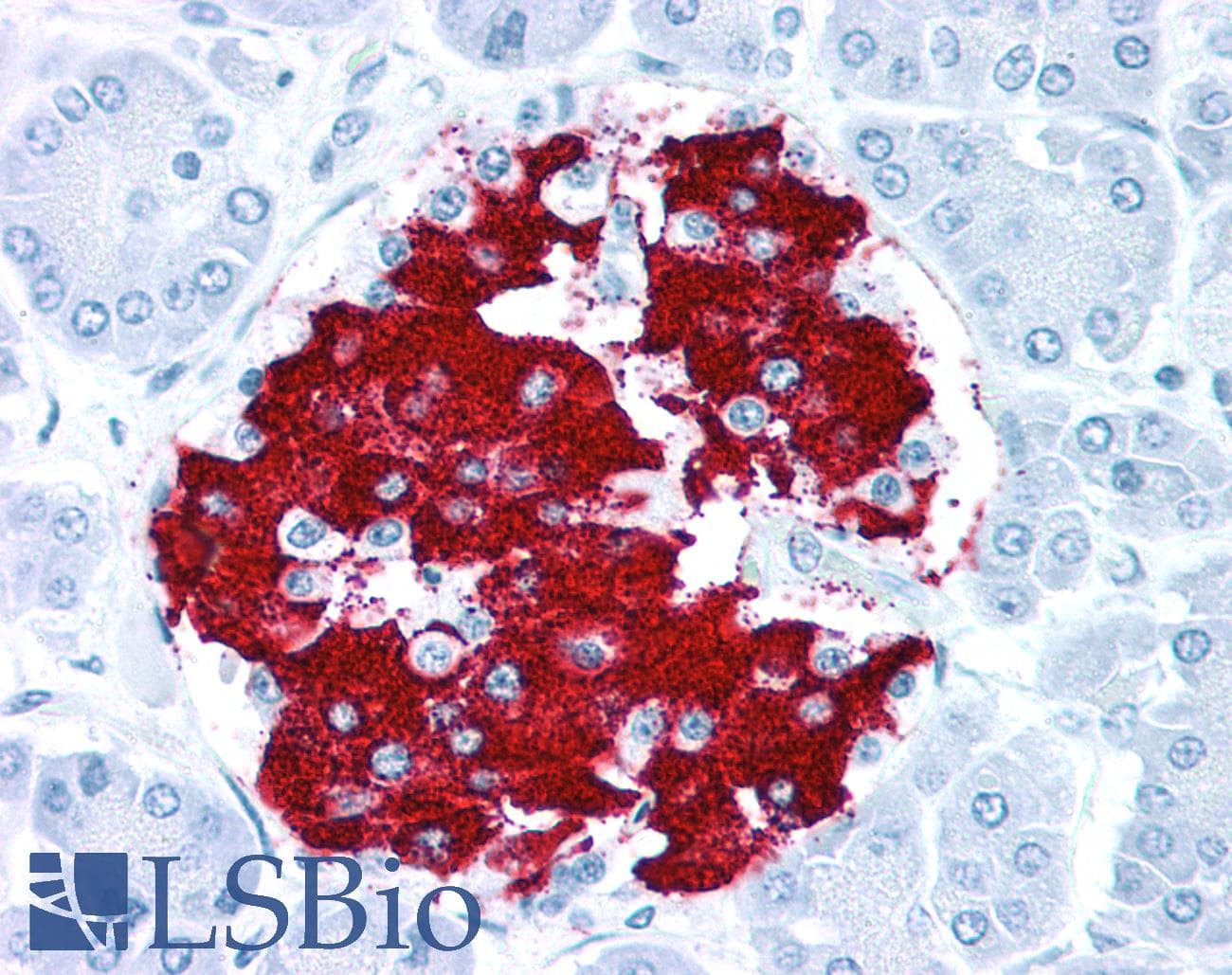 PathPlus™ Insulin Antibody