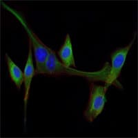 EGF Antibody (clone 4E+11)