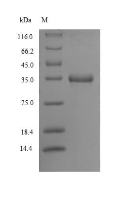Caenorhabditis bca-1 Protein (Recombinant 10His, N-terminus + Myc, C-terminus)