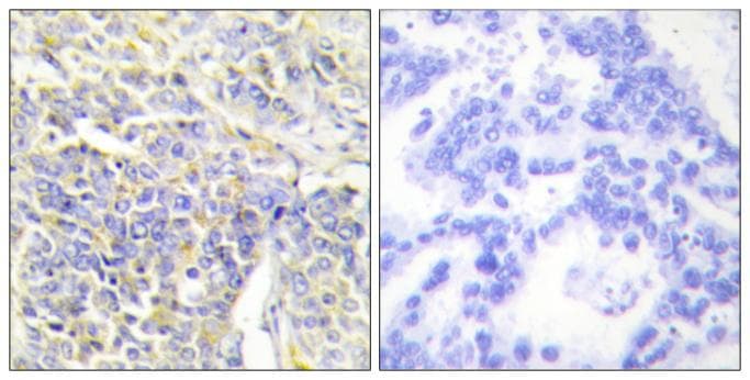 AK1 / Adenylate Kinase 1 Antibody