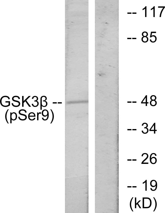 GSK3B / GSK3 Beta Antibody (phospho-Ser9)