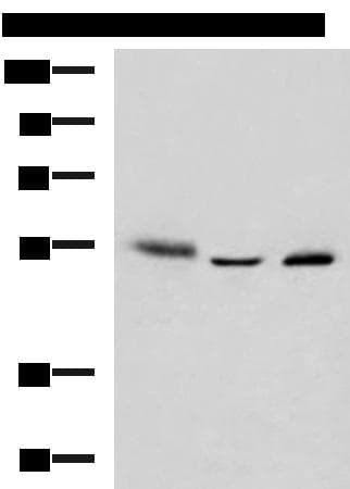 IKZF2 / HELIOS Antibody