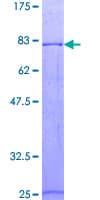 Human PROC / Protein C (Recombinant GST)