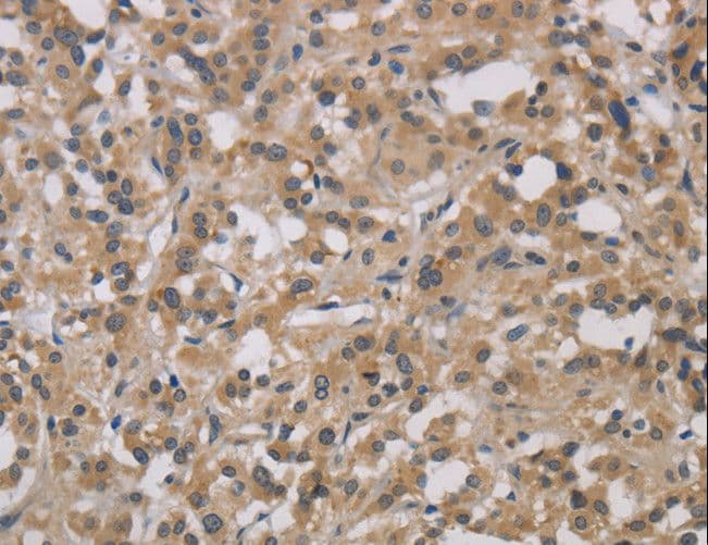 DCN / Decorin Antibody