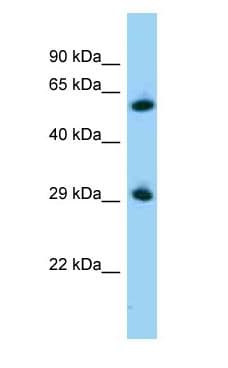 ZBTB7A / Pokemon Antibody (C-Terminus)