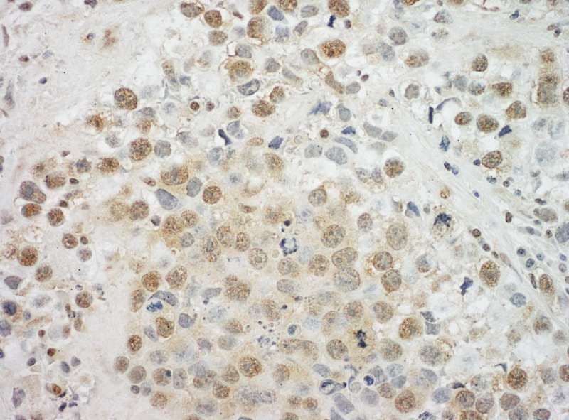 EYA4 Antibody (aa100-150)