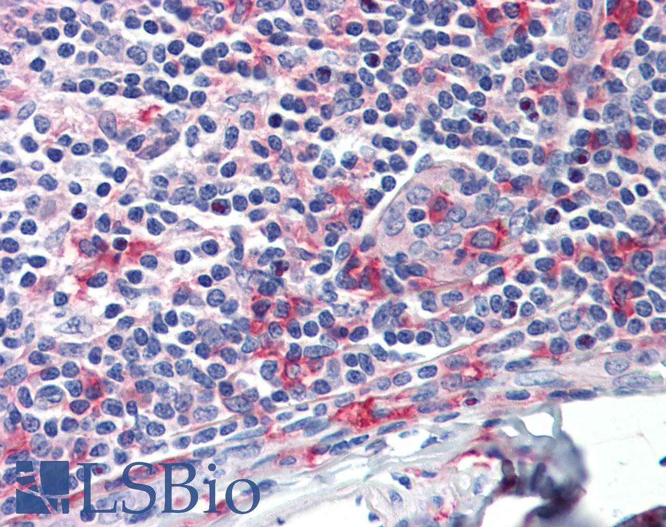 FCGR1A / CD64 Antibody (clone 3D3, Carrier-free)