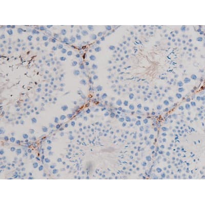 CDC25B Antibody (phospho-Ser323)