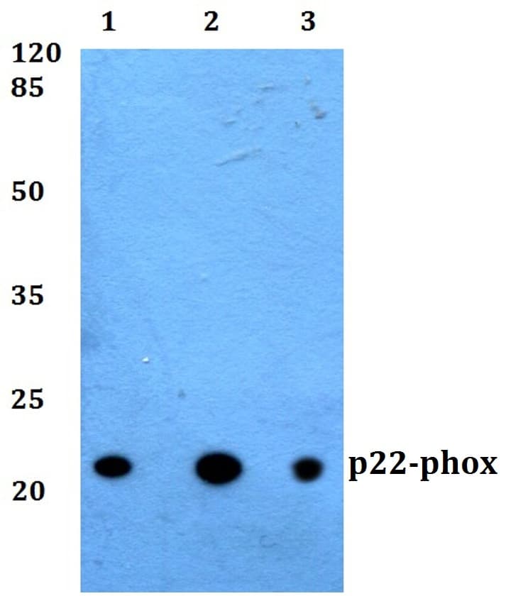 IHC-plus™ CYBA / p22phox Antibody