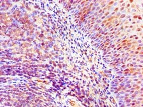 ASH2L / ASH2 Antibody (aa329-628)