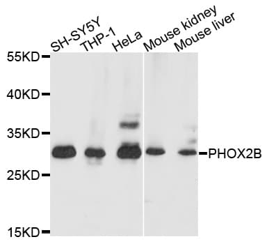 PHOX2B Antibody