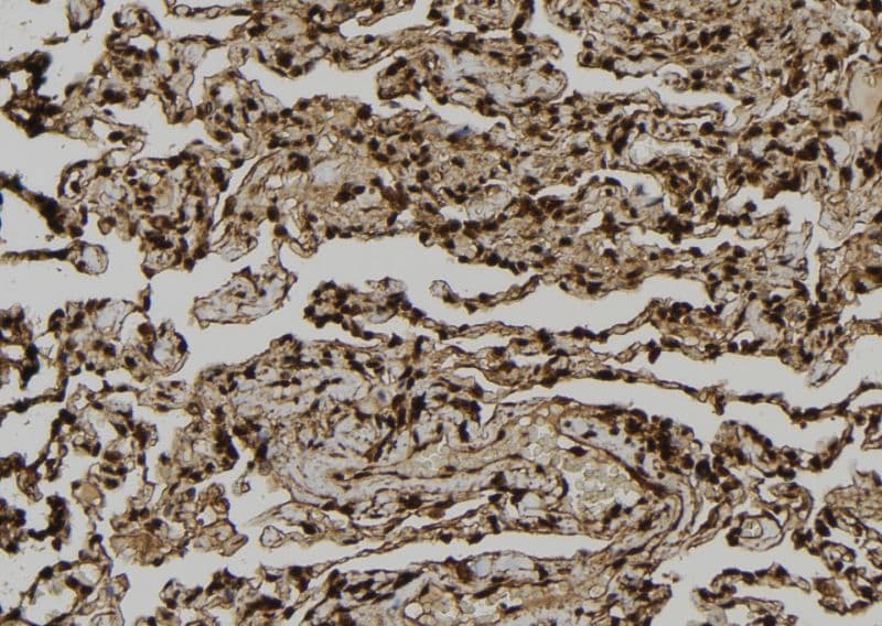 Polyclonal Rabbit anti-Human Dystonin / BPAG1 Antibody (IHC, IF, WB)