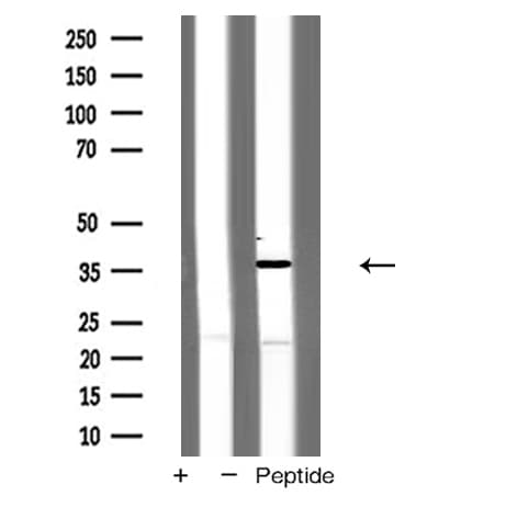 IHC-plus™ CTSB / Cathepsin B Antibody