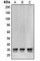 Polyclonal Rabbit anti-Human CBR / CBR1 Antibody (Internal, IHC, IF, WB)