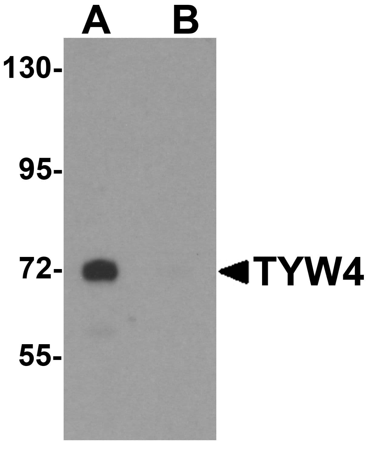 Polyclonal Rabbit anti-Human LCMT2 / YW4 Antibody (IHC, IF, WB)