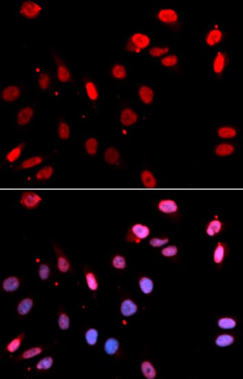 RAD18 Antibody
